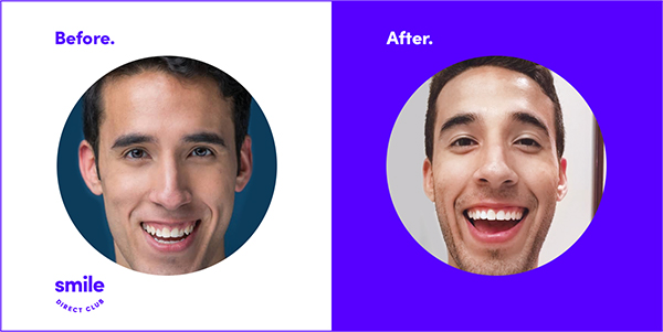 Dental Suite | Teeth Whitening, Ceramic Crowns and Dental Bridges